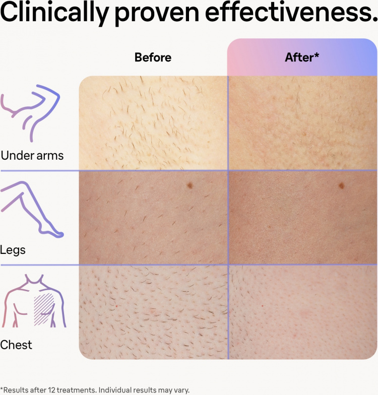 Braun Smart IPL Skin iexpert PL7253 IPL-apparat Braun Smart IPL Skin iexpert PL7253 IPL-apparat